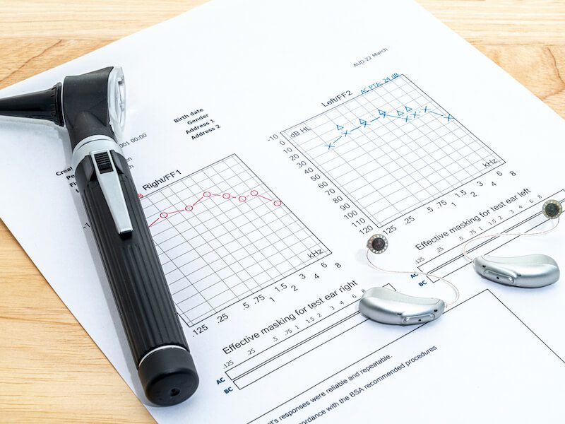 read_your_hearing_test_or_audiogram
